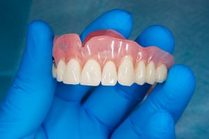 Truth about dentures, tooth replacement, bridge, dental implants